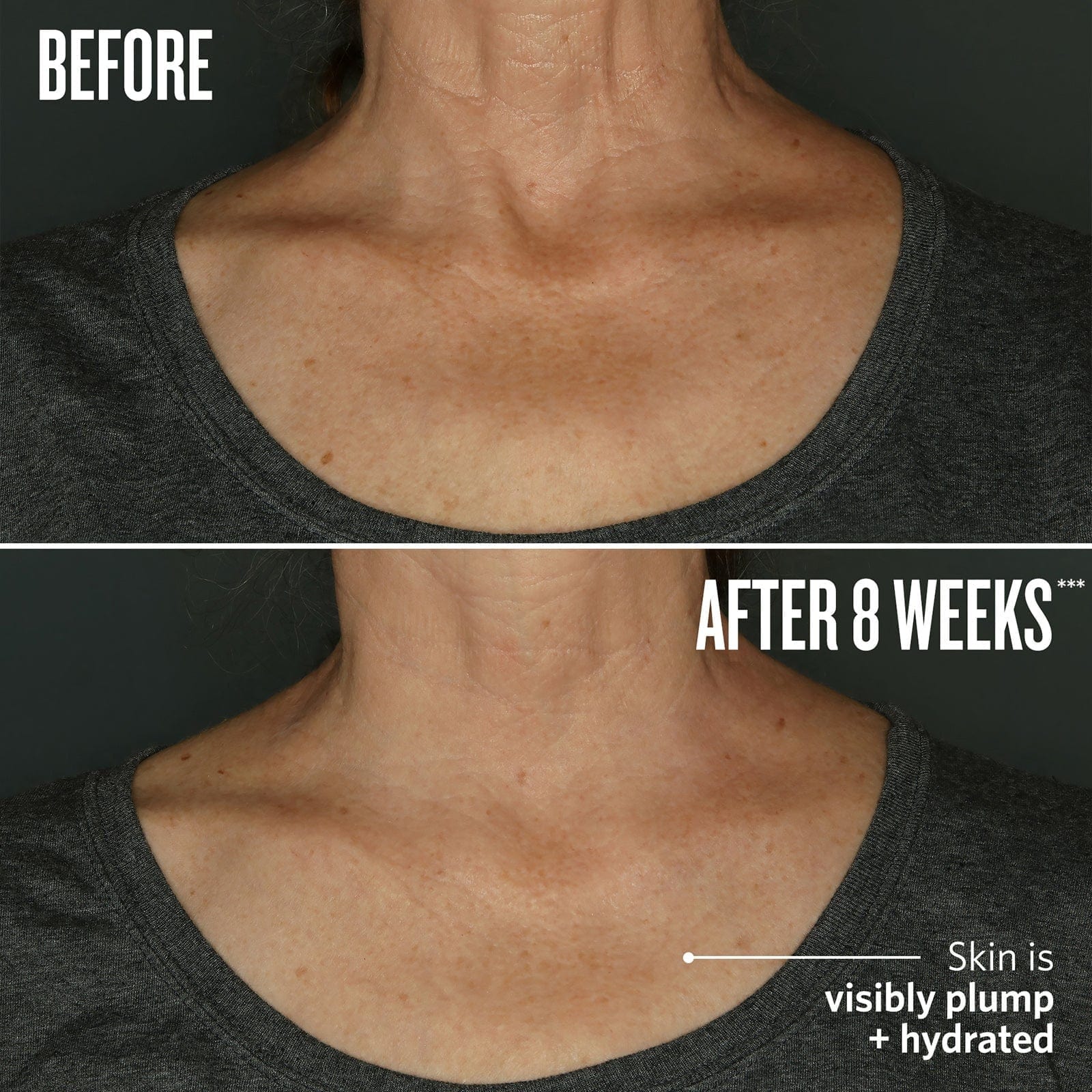 Before // After 8 weeks* skin is visibly plumped + hydrated