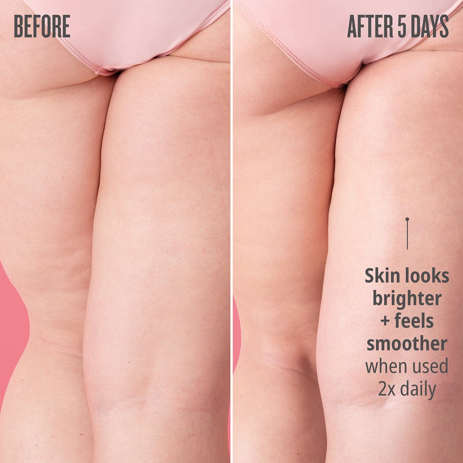 Before // After 5 days when used 2x daily, skin looks brighter + feels smoother.