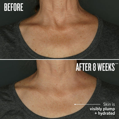 Before // After 8 weeks* skin is visibly plumped + hydrated